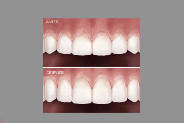 Periodoncia
