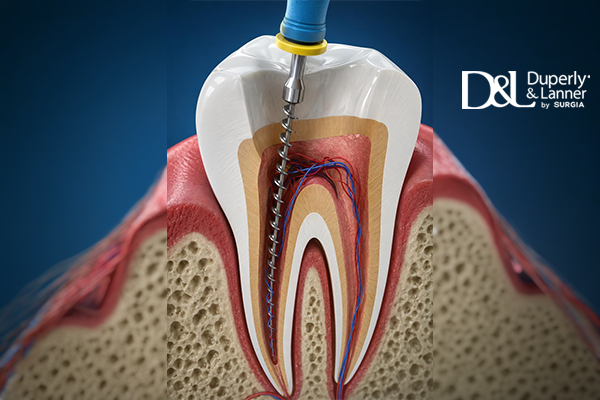Endodoncia