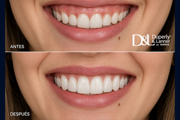 Periodoncia