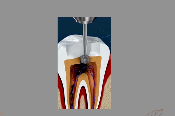 Rehabilitación oral y estética dental