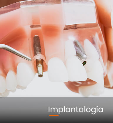 Duperly_implantologia_0