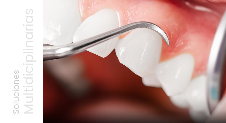 periodoncia_feb_00 (1)