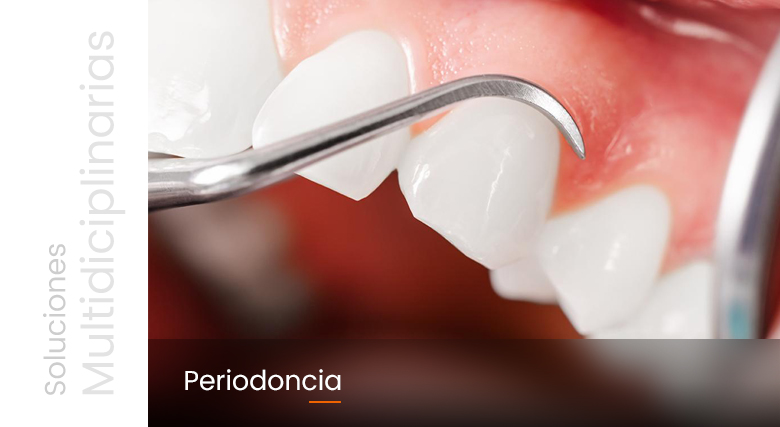 periodoncia_feb_01 (1)